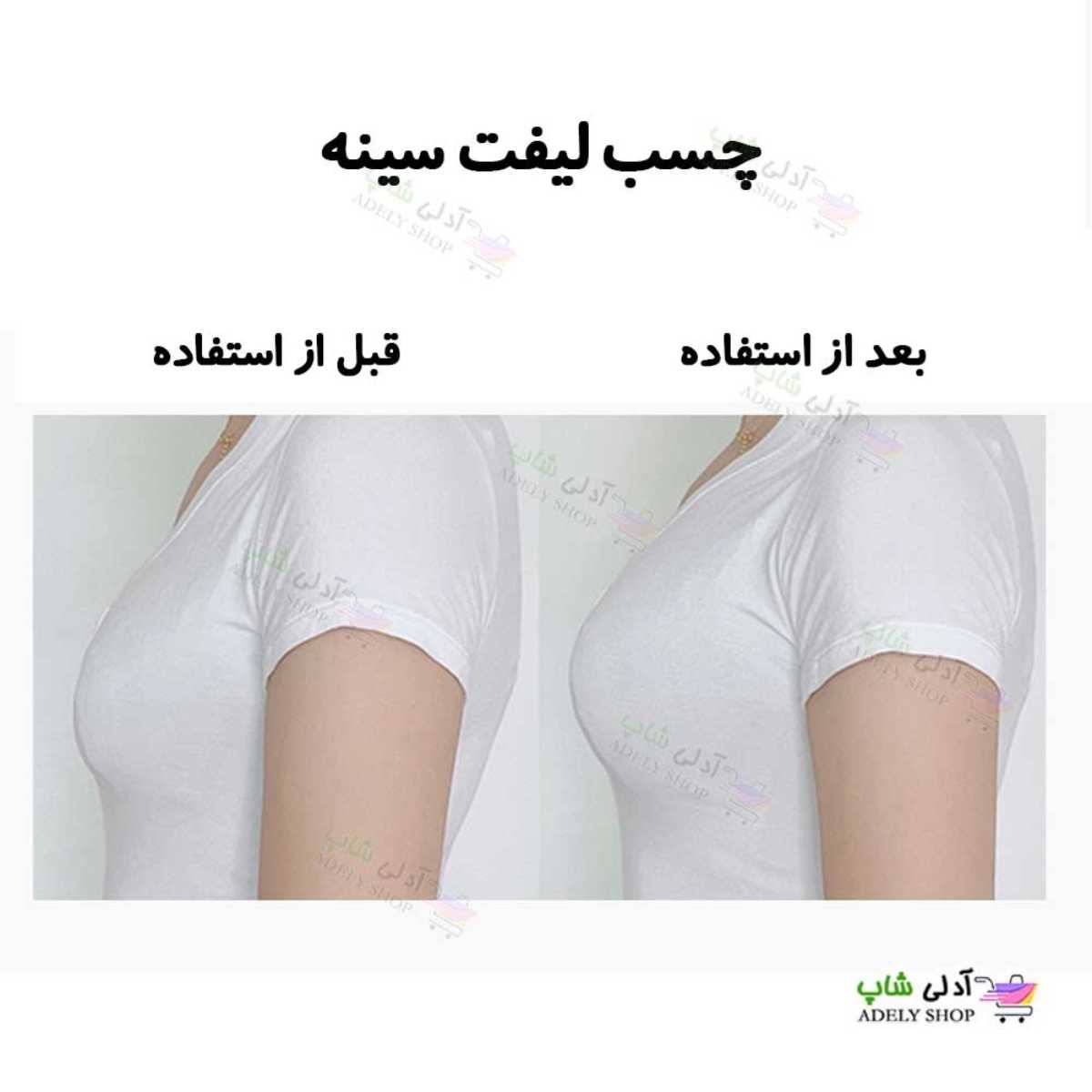 تصویر چسب لیفت سینه 4 عدد