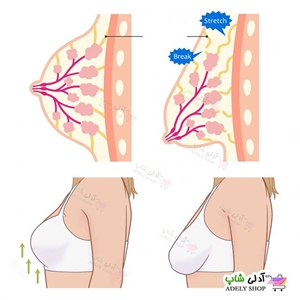 جلوگیری از افتادگی سینه با انتخاب سوتین مناسب